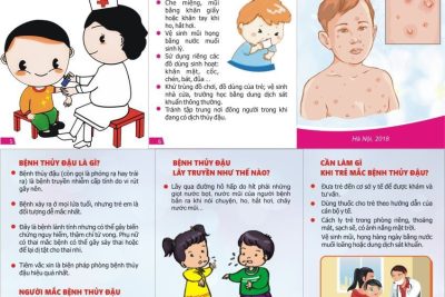 Hãy nâng cao tinh thần cảnh giác về bệnh thủy đậu cho trẻ ở trường mầm non.